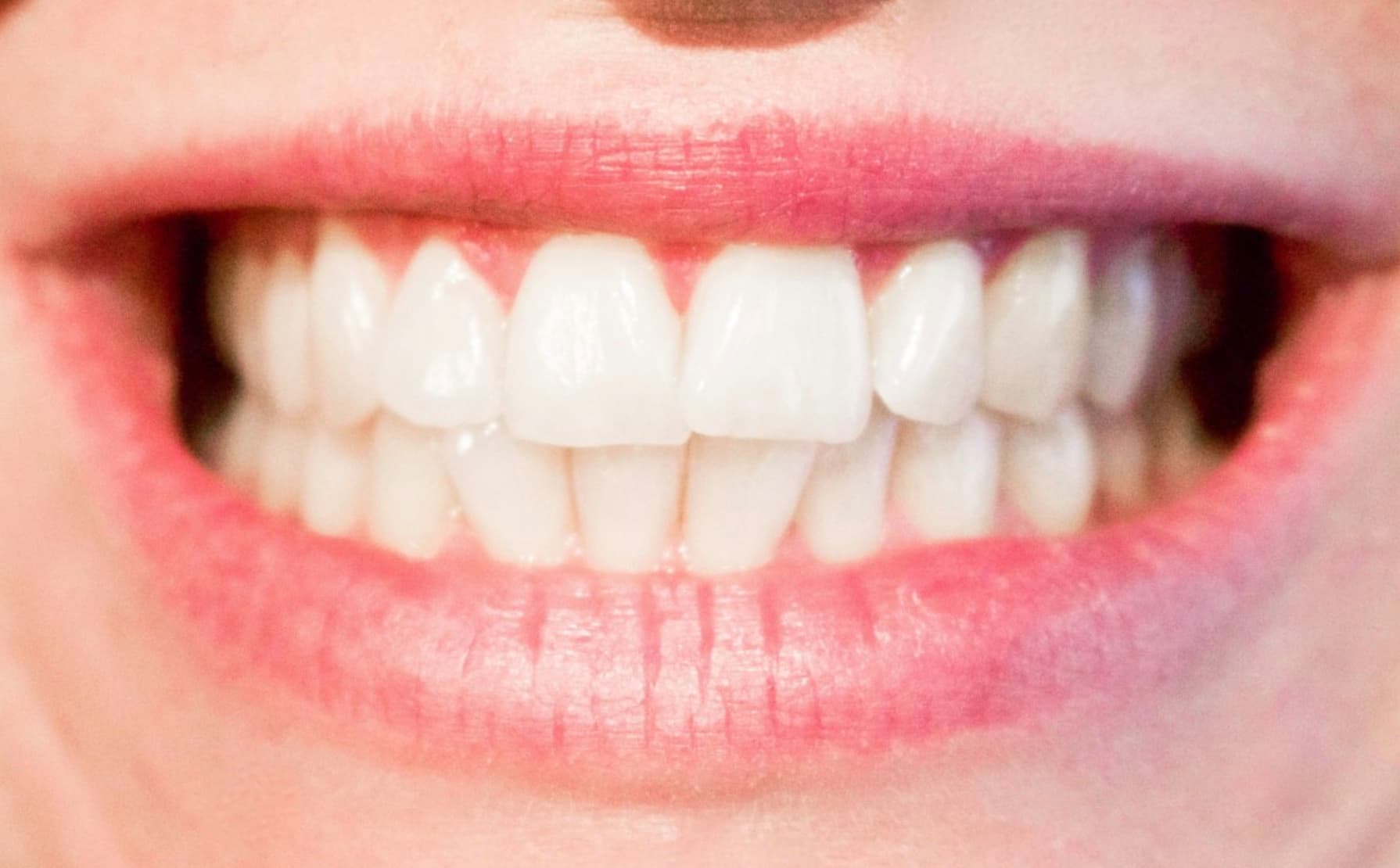 5 Tips to Take Care of Your Braces