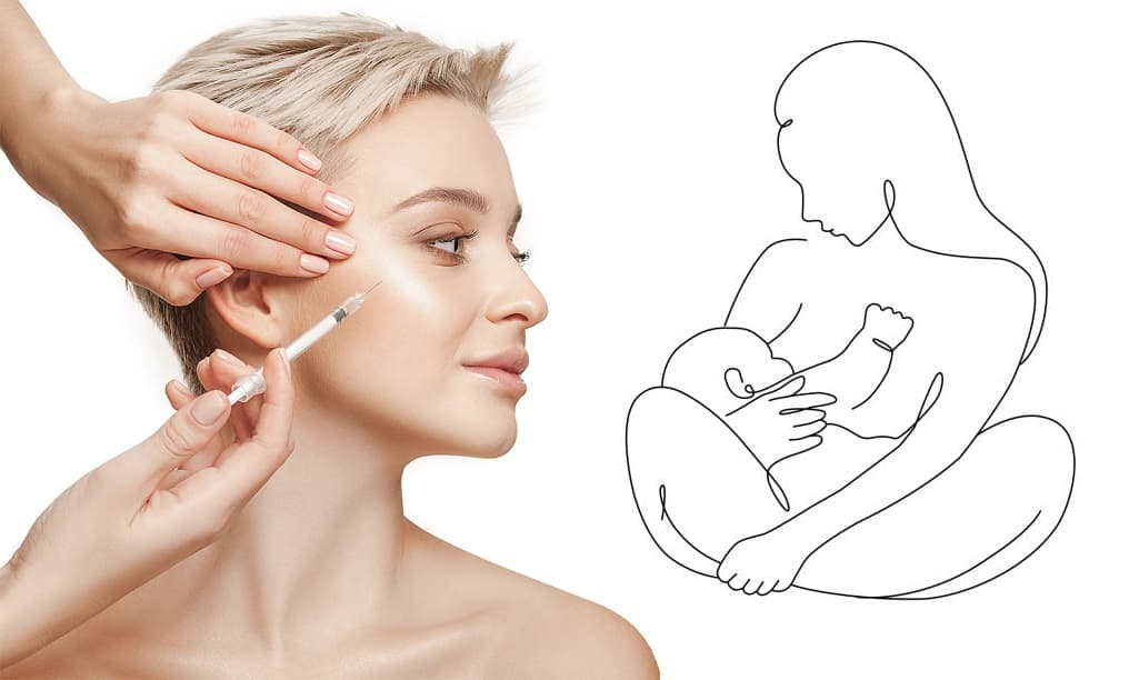 Can You Get Botox While Breastfeeding – Is There Any Harm?