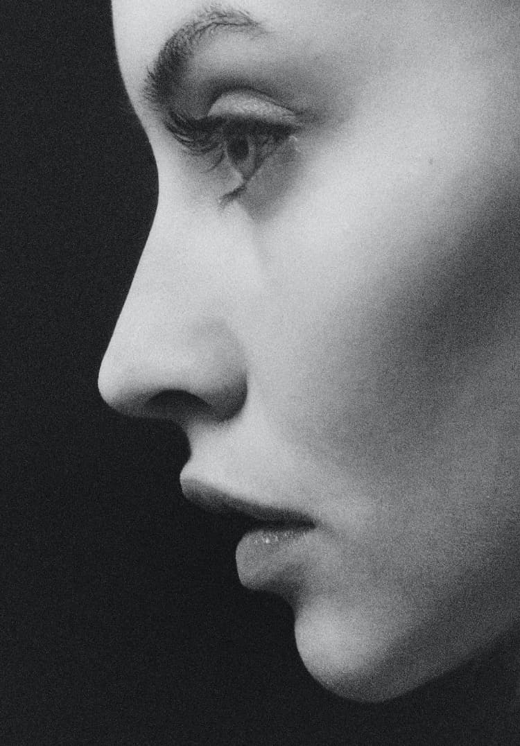 Reasons Why You Should Consider Getting Botox