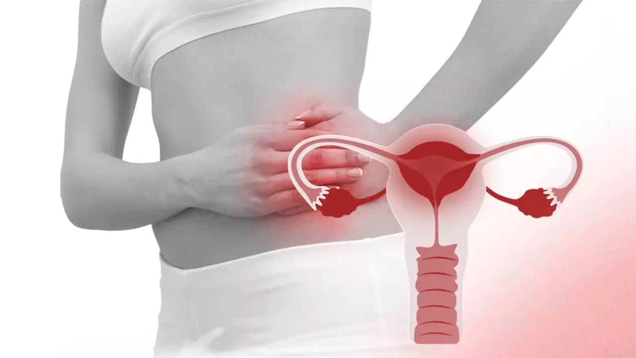 pelvic congeston featured
