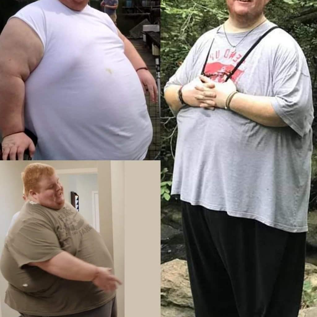 Casey King before and after weight loss
