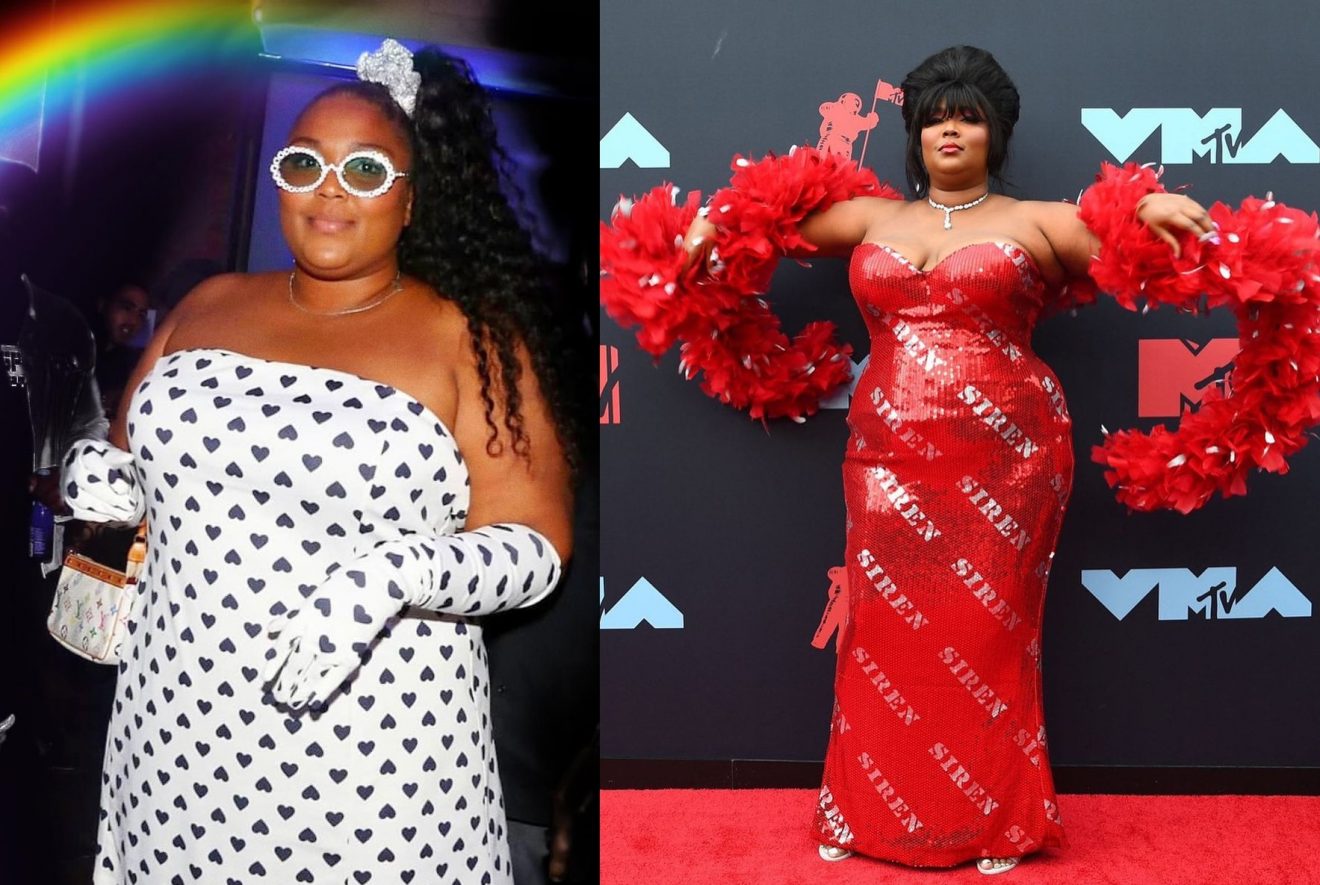 Lizzo's Weight Loss Surgery The Journey Of The Body Positivity Activist