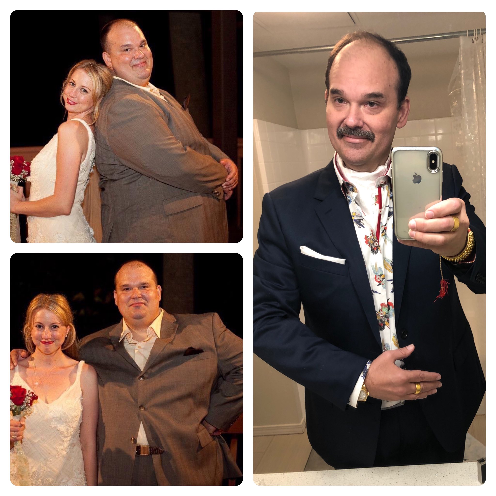 mel rodriguez before and after