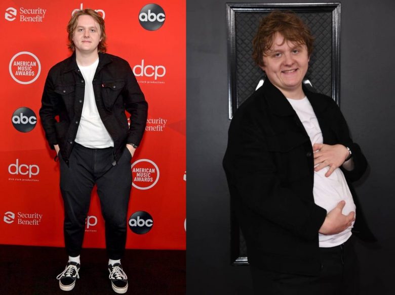 Lewis Capaldi Weight Gain Journey: Insights and Understanding