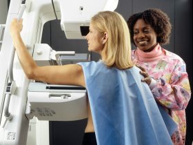 smiling woman standing near another woman beside mammogram machine